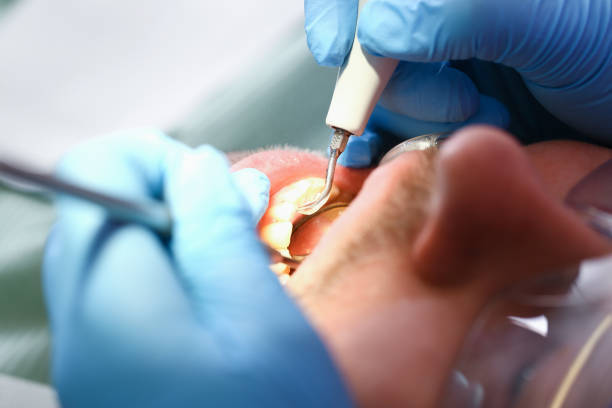 Best Cracked Tooth Emergency Dentist  in Woodmont, CT