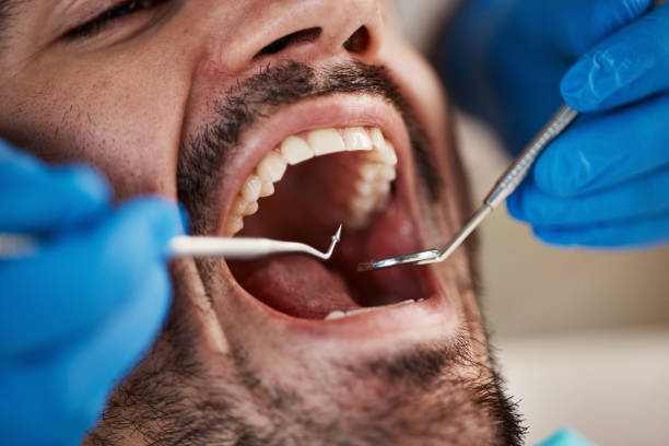 Best Tooth Infection Emergency Dentist  in Woodmont, CT